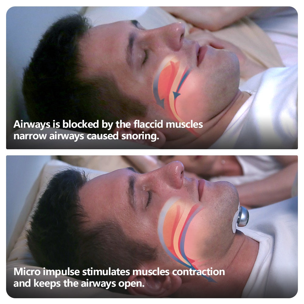 Smart Anti Snoring Device Electronic Muscle Stimulator Pro.