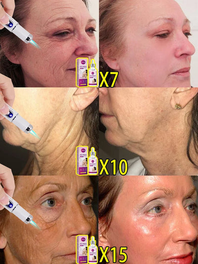 Remove facial and neck wrinkles firming moisturizing.