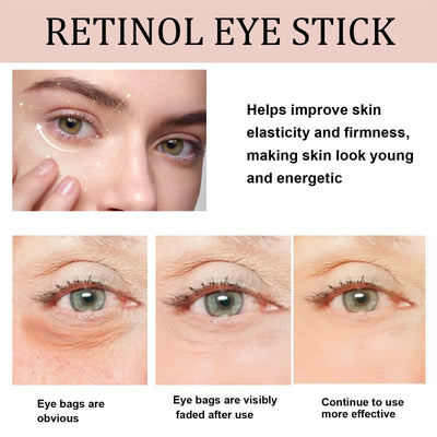 Retinol Wrinkle Removal Eye Cream Anti Dark Circles.