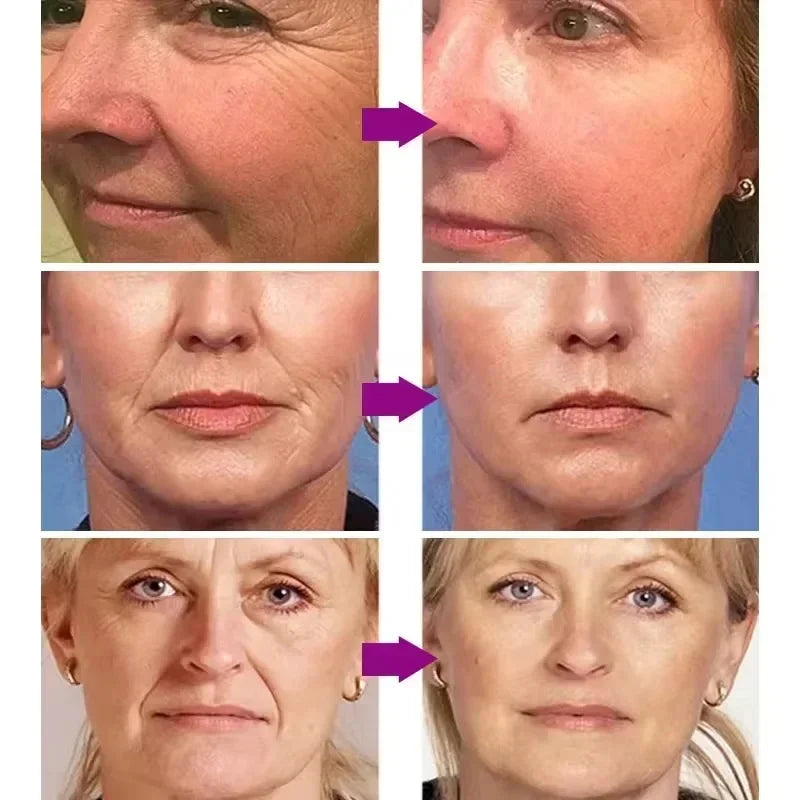 Retinol Wrinkle Remover Face Set Serum.