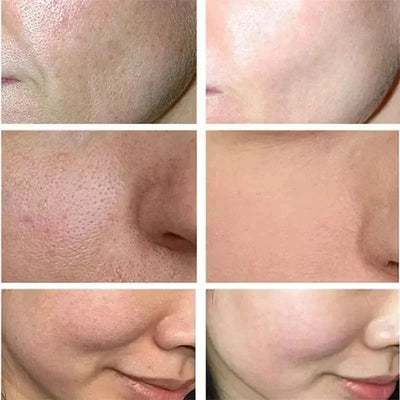Japan Sakura Wrinkle Remover Face Serum Cream Anti-Aging Fade.