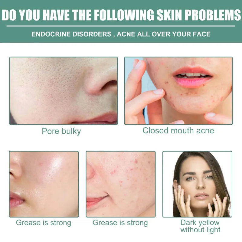 Instant Wrinkle Remove Serum Retinol Anti Agi-ng.