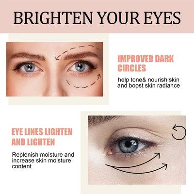 Retinol Wrinkle Removal Eye Cream Anti Dark Circles.