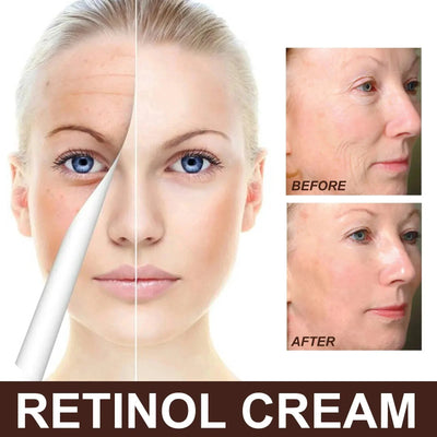 Retinol Wrinkle Remover Face Set Serum.