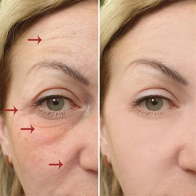 Retinol Wrinkle Remover Face Set Serum.