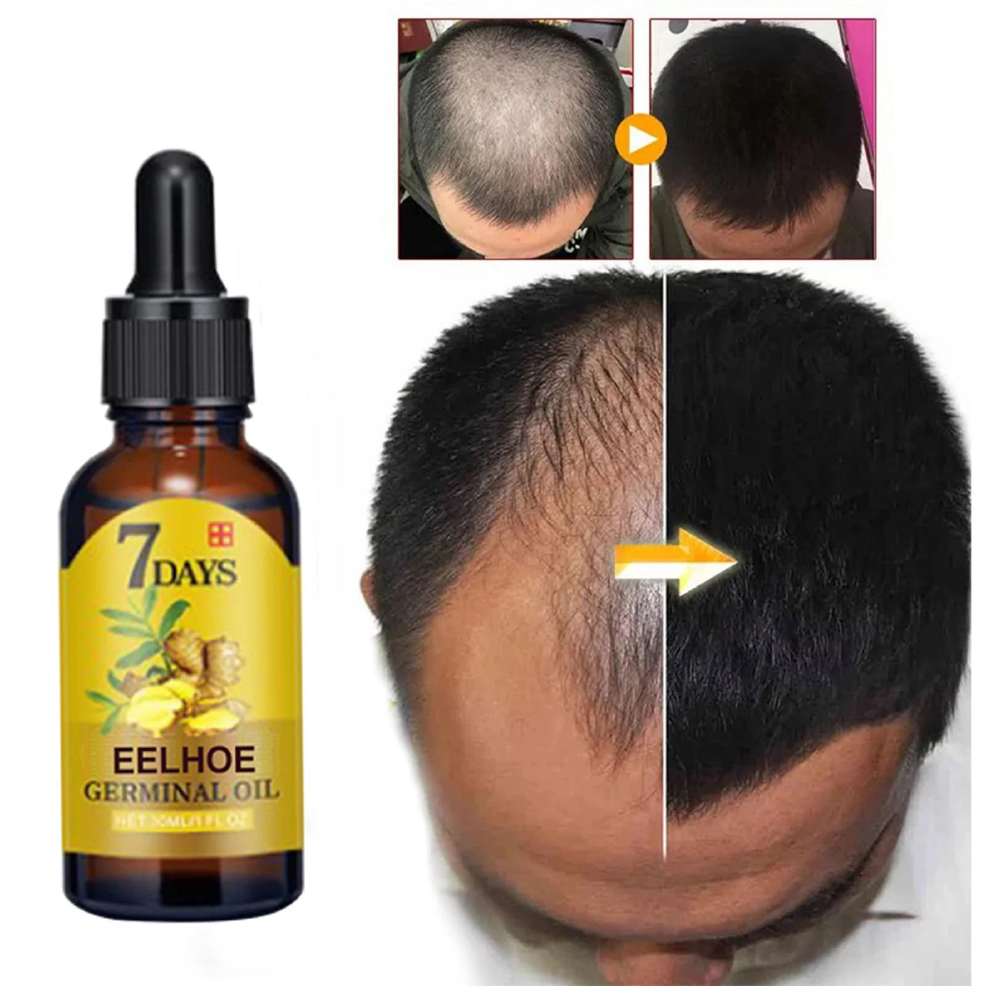 Ginger Hair Care Oil Hair Roots Scalp Treatment.