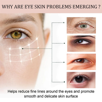 Retinol Wrinkle Removal Eye Cream Anti Dark Circles.