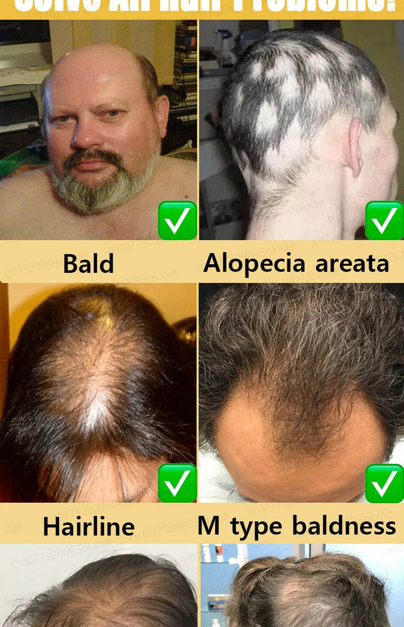Magic Hair growth essential 0iI.