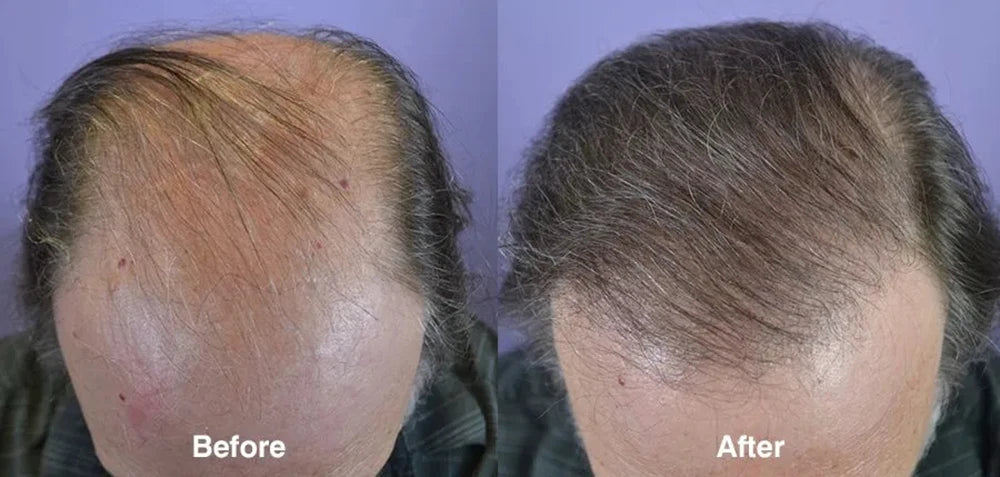Ginger Hair Care Oil Hair Roots Scalp Treatment.