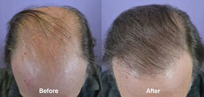 Ginger Hair Care Oil Hair Roots Scalp Treatment.