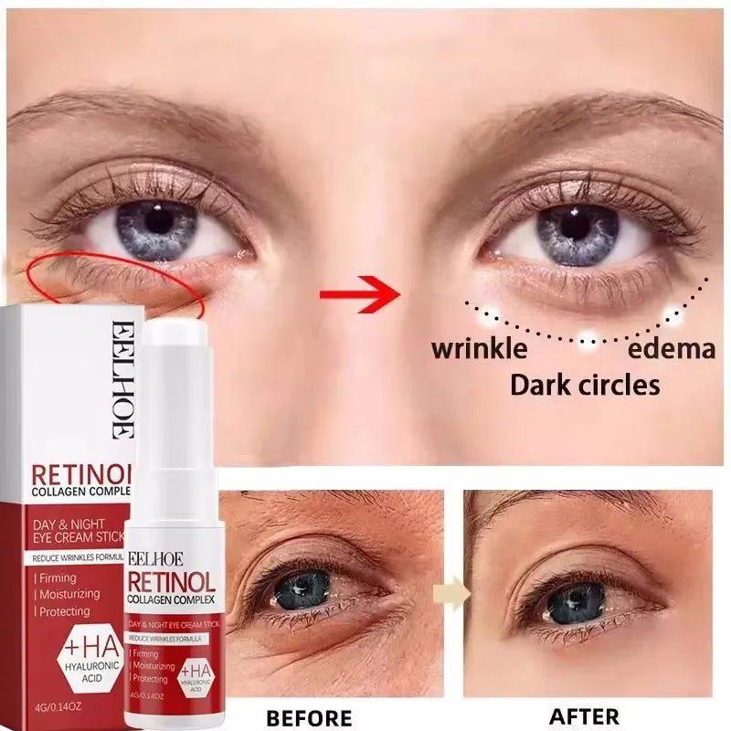 Retinol Wrinkle Remover Face Set Serum.