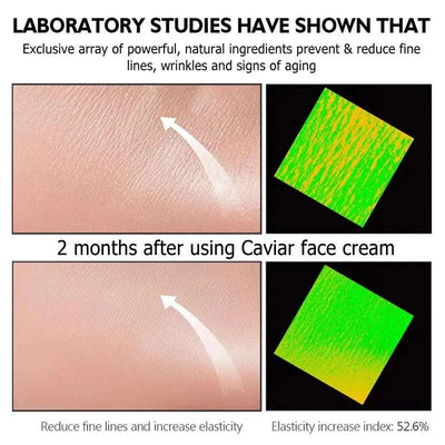 Caviar Wrinkle Remover cream reduces fine lines and increases skin elasticity by 52.6% after 2 months of use