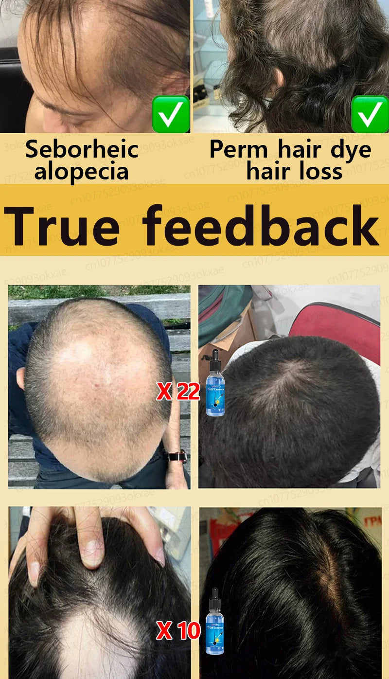Magic Hair growth essential 0iI.
