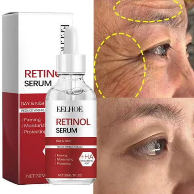 Retinol Wrinkle Remover Face Set Serum.