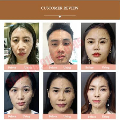 Hana cure Mask Facial Mask Therapy.