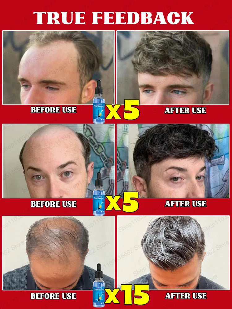 Magic Hair growth essential 0iI.