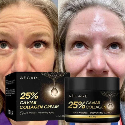 Before and after comparison of woman's forehead showing reduced wrinkles using Afcare 25% Caviar Collagen Cream anti-wrinkle face cream