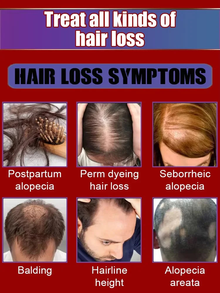 Magic Hair growth essential 0iI.