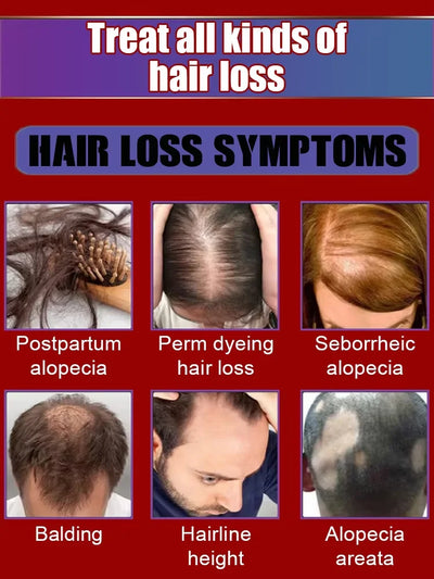 Magic Hair growth essential 0iI.