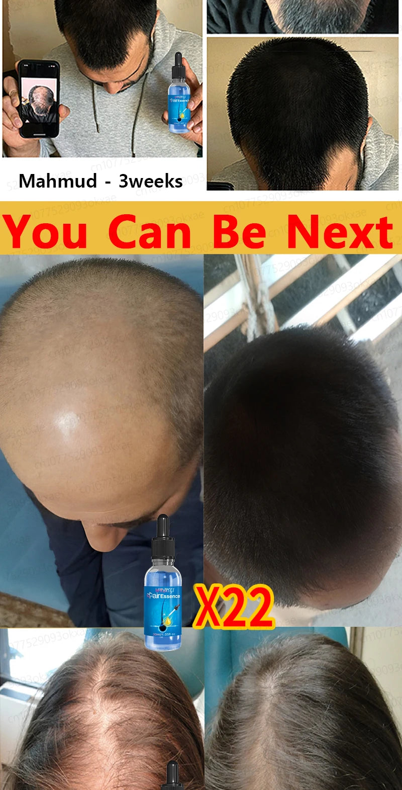 Magic Hair growth essential 0iI.