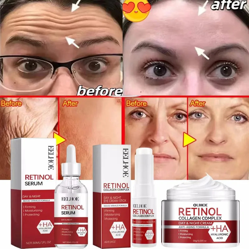 Retinol Wrinkle Remover Face Set Serum.