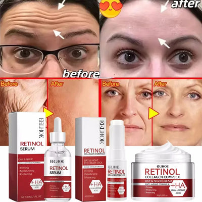 Retinol Wrinkle Remover Face Set Serum.