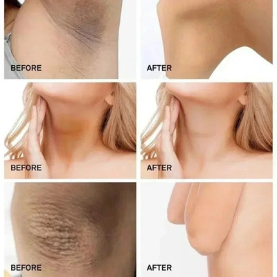 Brightening Cream For Dark Skin Effective Lighten Thigh Inner Bleach Remove.