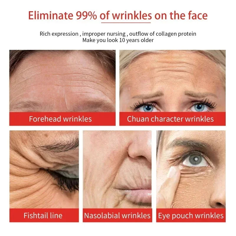 Retinol Wrinkle Remover Face Set Serum.