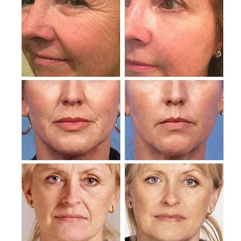 Before and after photos showing wrinkle reduction and firmer skin from using Caviar Wrinkle Remover face cream with collagen and eye mask.