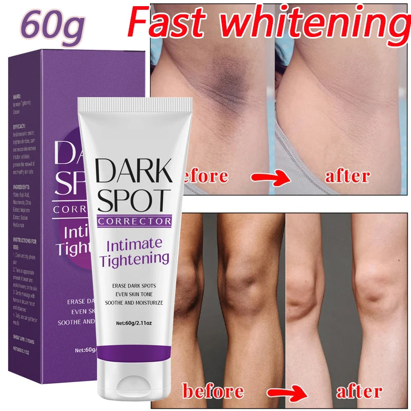 Brightening Cream For Dark Skin Effective Lighten Thigh Inner Bleach Remove.