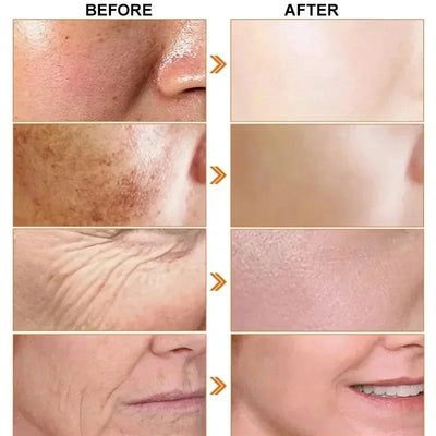 Japan Sakura Wrinkle Remover Face Serum Cream Anti-Aging Fade.
