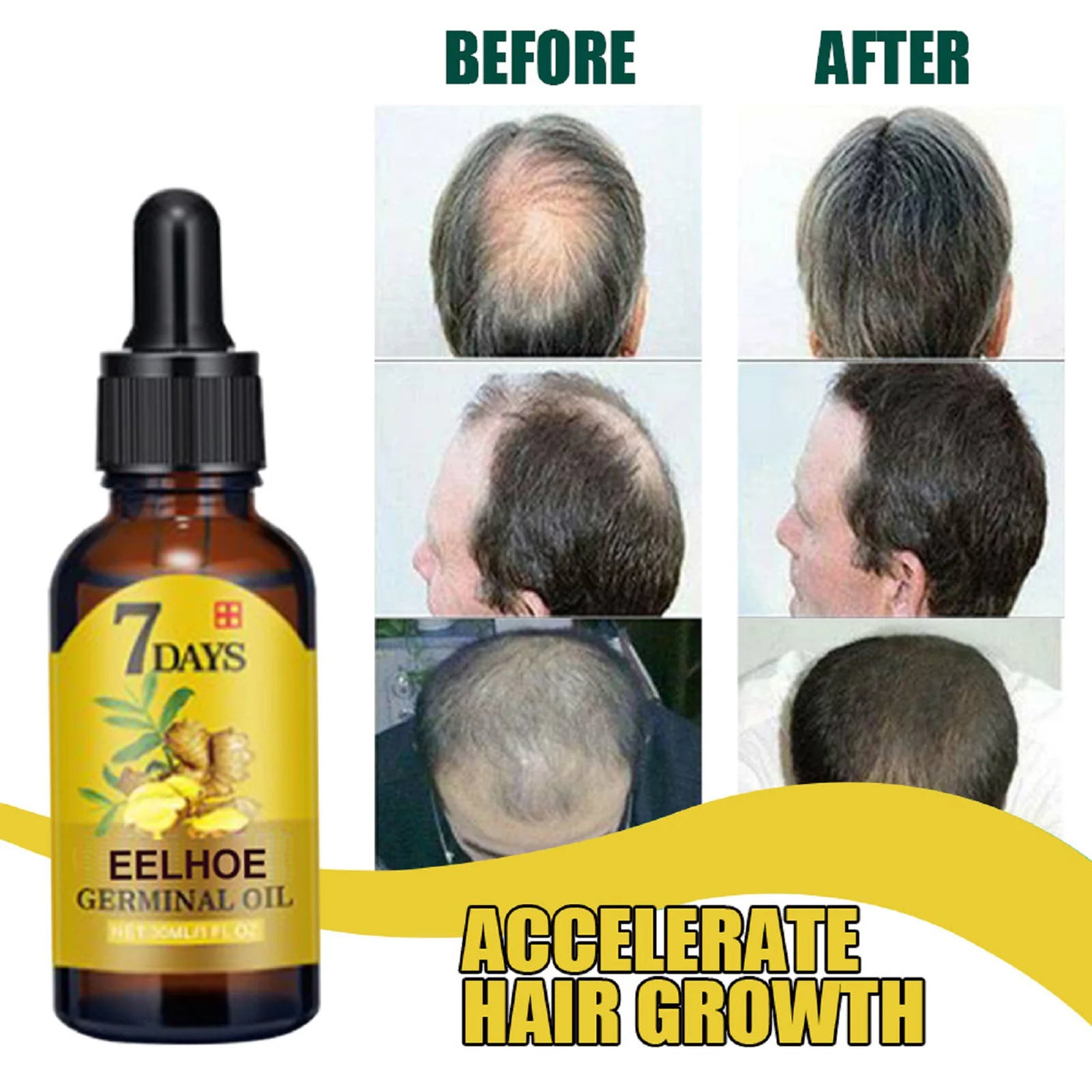 Ginger Hair Care Oil Hair Roots Scalp Treatment.