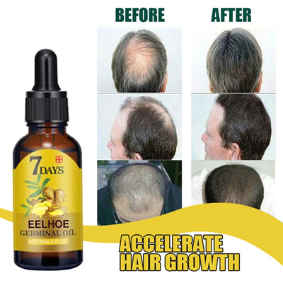 Ginger Hair Care Oil Hair Roots Scalp Treatment.