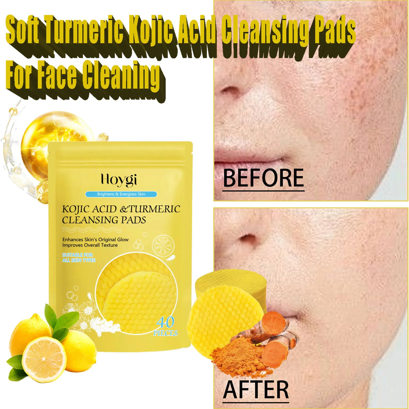 Turmeric Kojic Acid Cleansing Pads Exfoliating Pads.