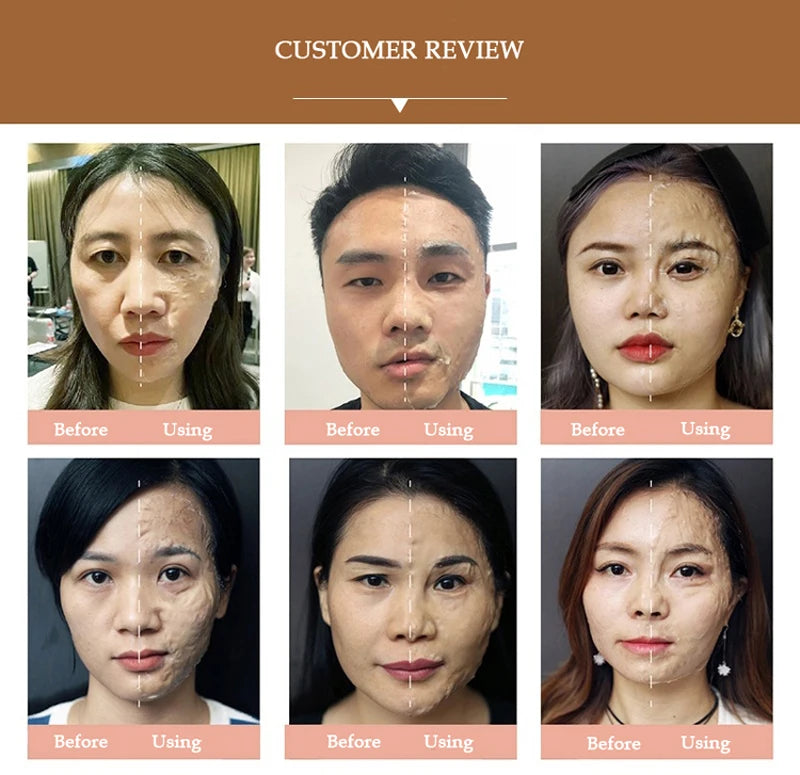 Hana cure Mask Facial Mask Therapy.