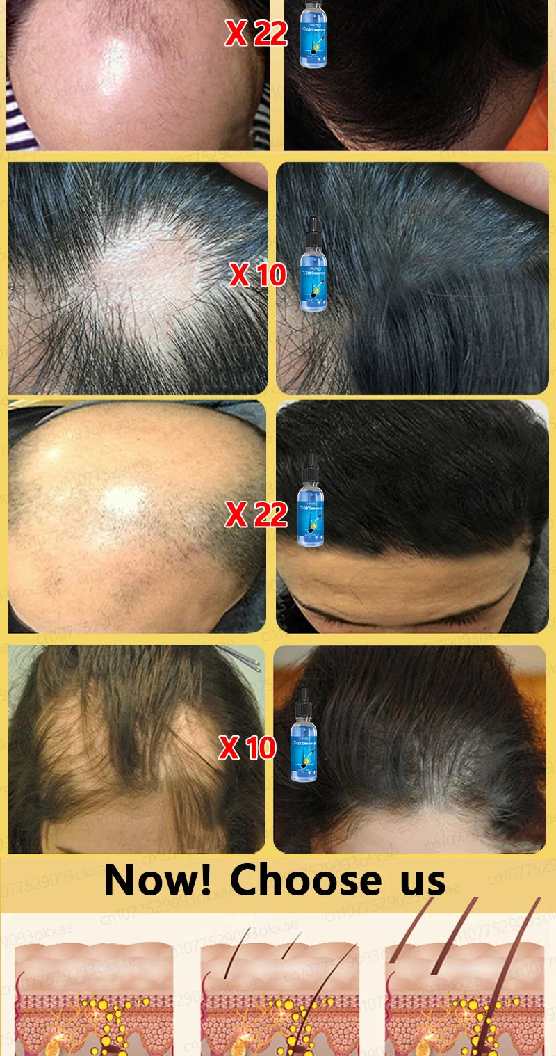 Magic Hair growth essential 0iI.
