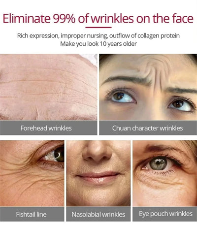 Retinol Wrinkle Remover Face Set Serum.