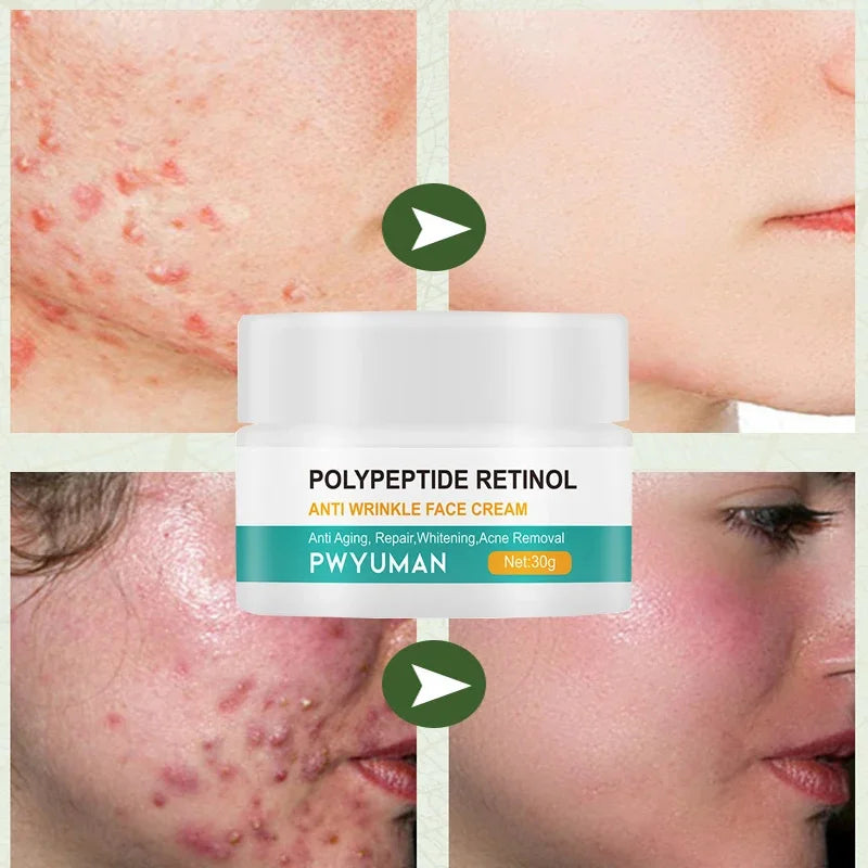 Instant Retinol Lifting Firming Cream Polypeptide Wrinkle Remover.