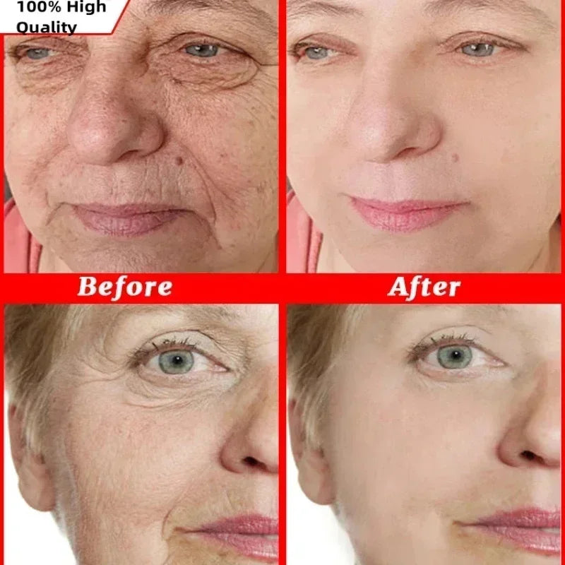 Japan Sakura Wrinkle Remover Face Serum Cream Anti-Aging Fade.