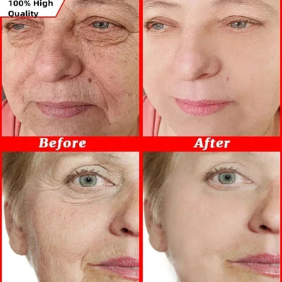 Japan Sakura Wrinkle Remover Face Serum Cream Anti-Aging Fade.