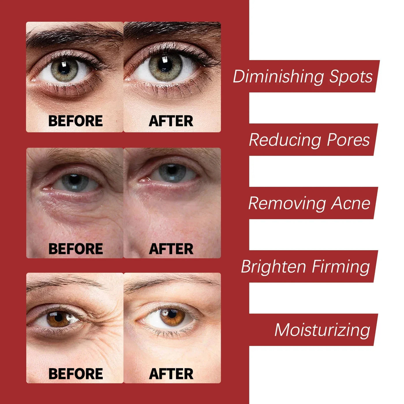 Retinol Wrinkle Remover Face Set Serum.