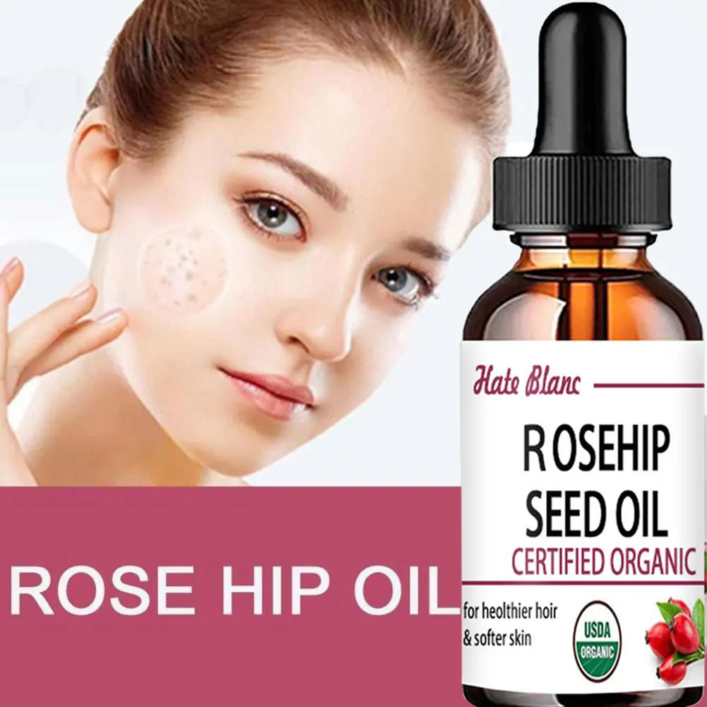 Pure Essential Oils Rosehip Oil Moisturizing Brighten Skin Color.