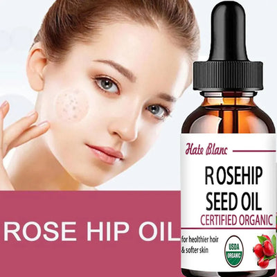 Pure Essential Oils Rosehip Oil Moisturizing Brighten Skin Color.