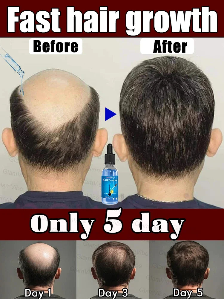 Magic Hair growth essential 0iI.