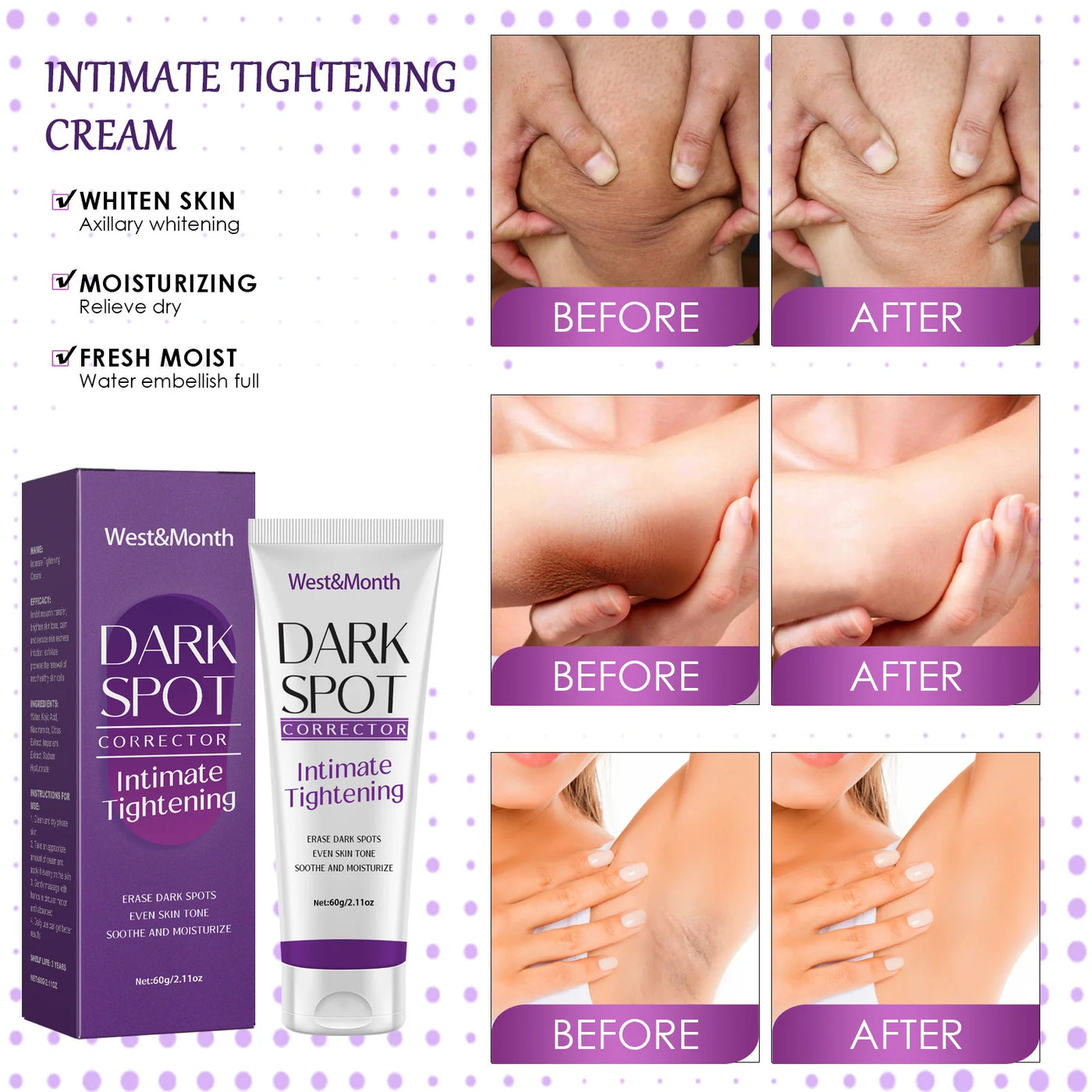 Brightening Cream For Dark Skin Effective Lighten Thigh Inner Bleach Remove.