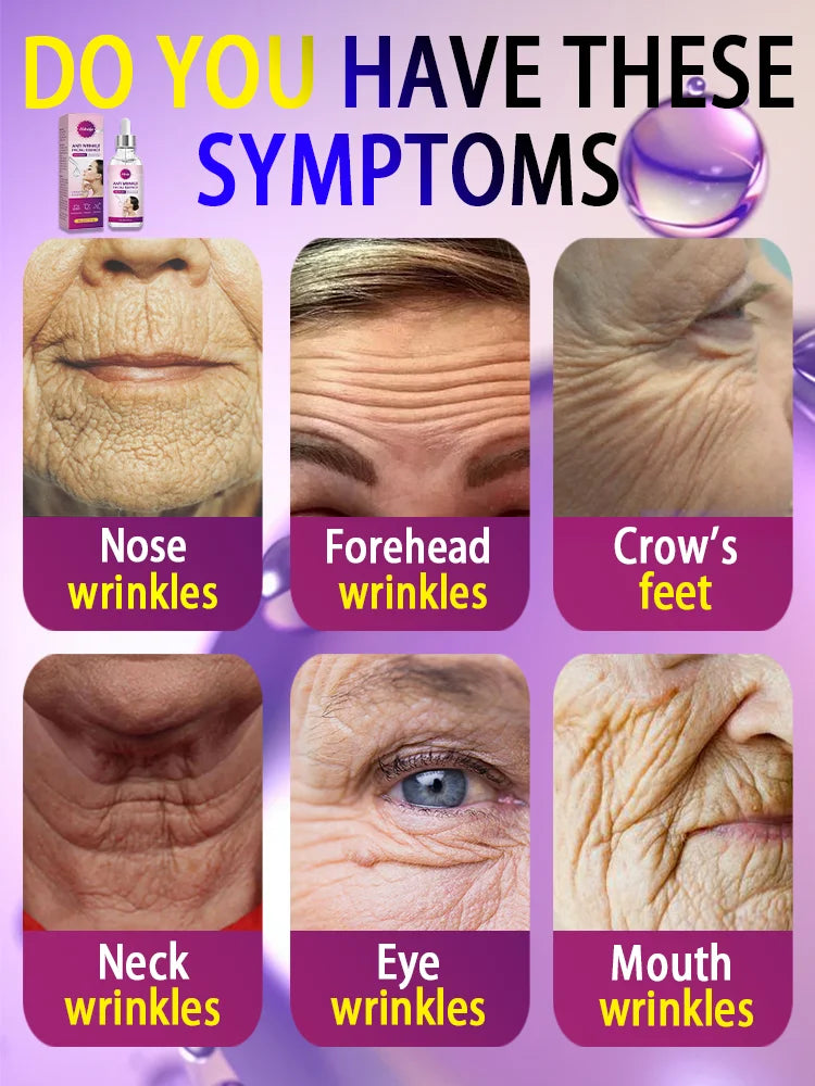 Remove facial and neck wrinkles firming moisturizing.